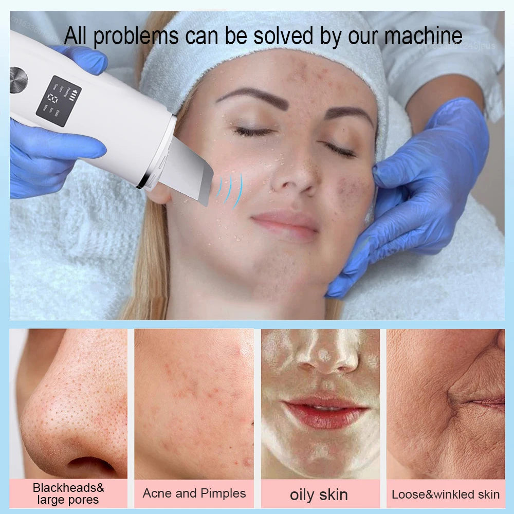Ultrasonic Face Scrubber – Deep Facial Cleansing Spatula for Acne, Pore Cleaning, and Skin Peeling – Ultrasonic Facial Cleanser for Radiant, Clear Skin