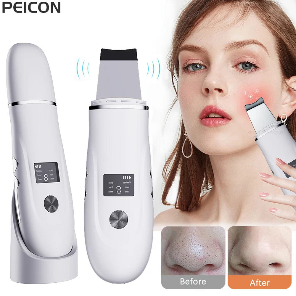 Ultrasonic Face Scrubber – Deep Facial Cleansing Spatula for Acne, Pore Cleaning, and Skin Peeling – Ultrasonic Facial Cleanser for Radiant, Clear Skin